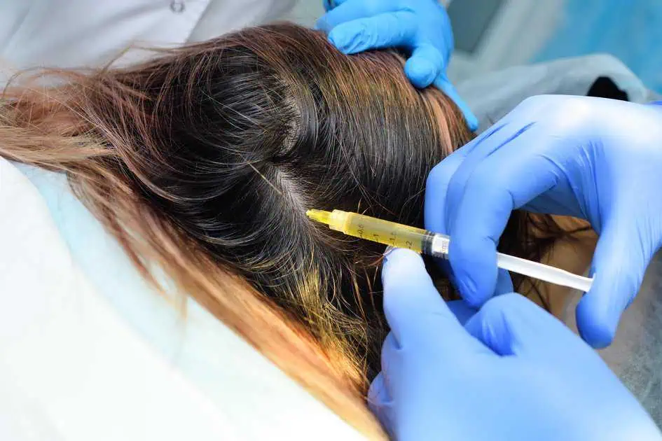 PRP Injections for Hair Restoration by The Honey Dipped Injector in Parker & Englewood CO